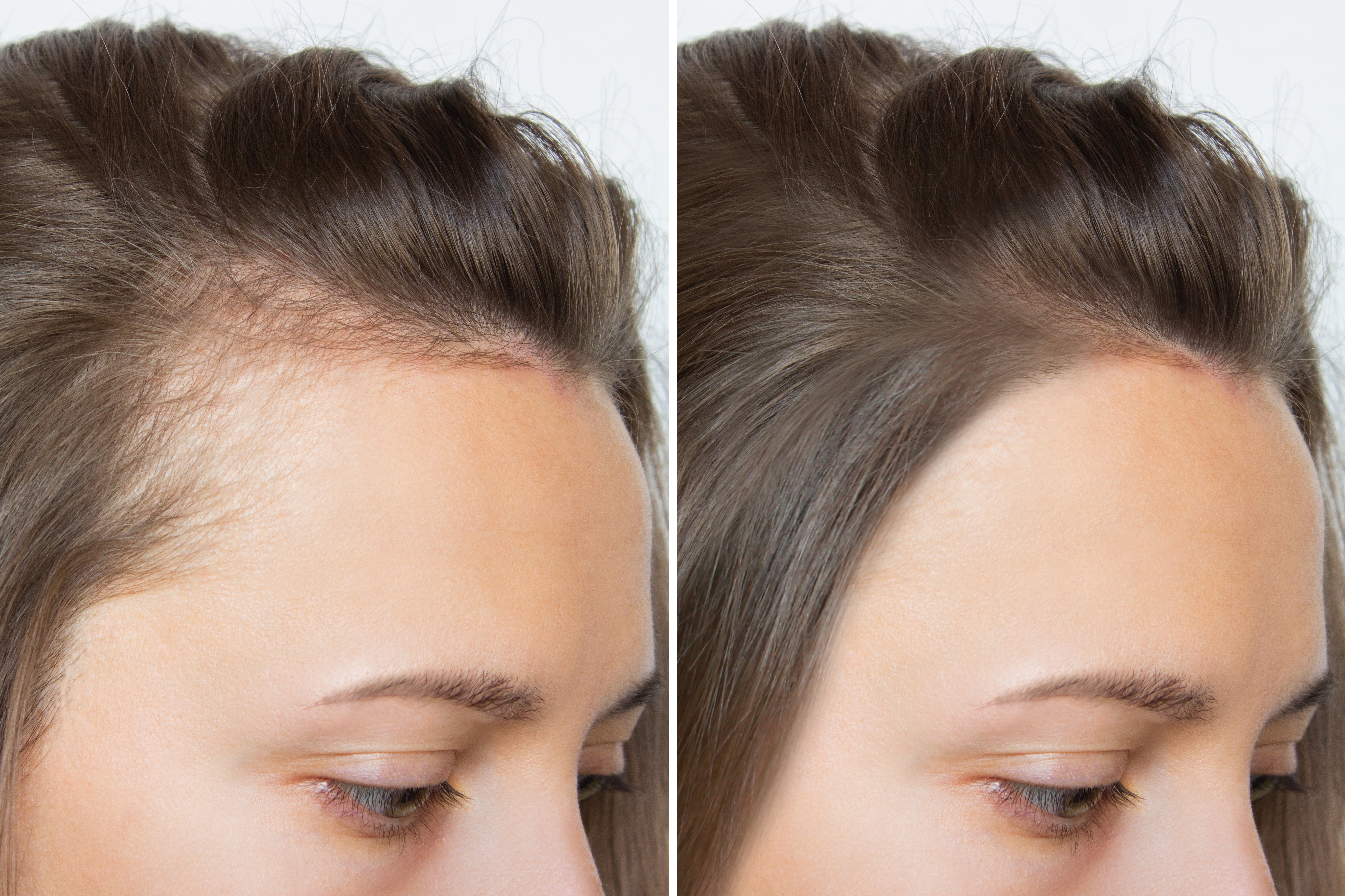 Does Colostrum Help With Hair Growth?